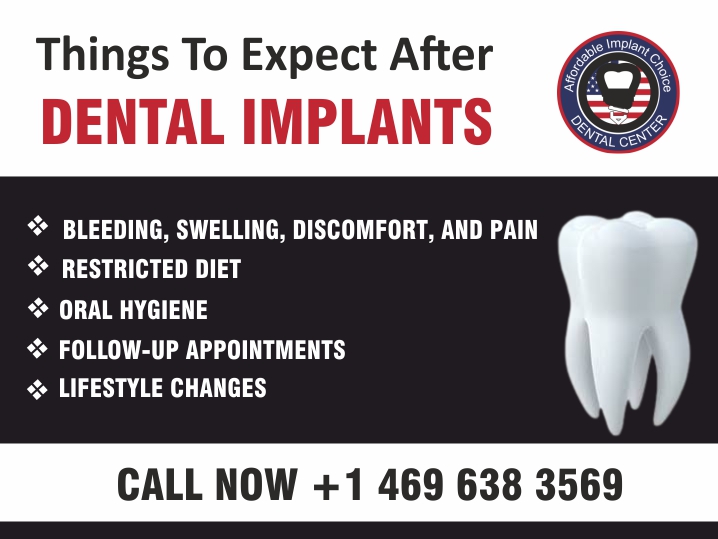 What To Expect After Dental Implants Surgery