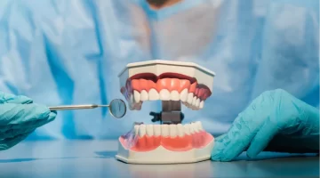 How Long Does It Take For A Dental Bridge To Settle?