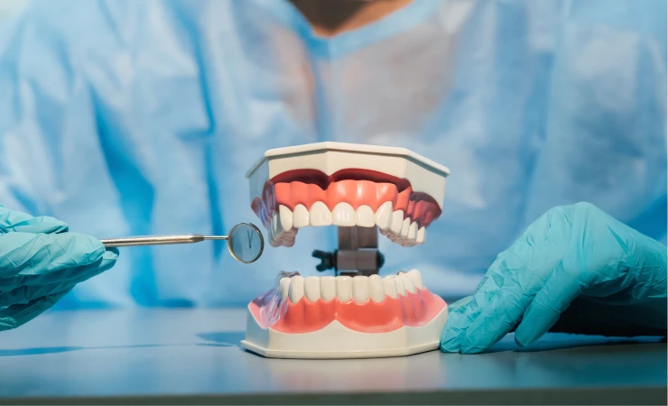 How to Care For Dental Bridges