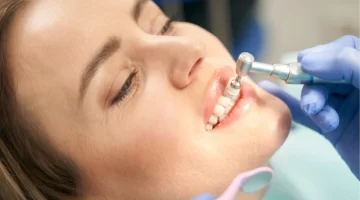Five Affordable Dental Options to Replace Missing Teeth