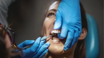 How Long Does Dental Bonding Last?