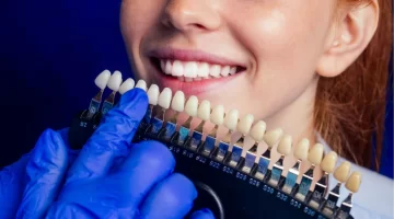 How Long Does A Dental Crown Last?