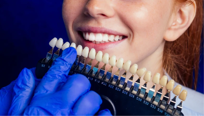 How Long Does A Dental Crown Last?