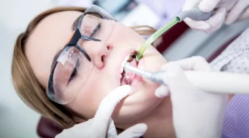 How Long Do Root Canals Last?
