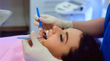 How long does teeth whitening take?