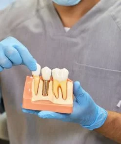 dental implant 248x295